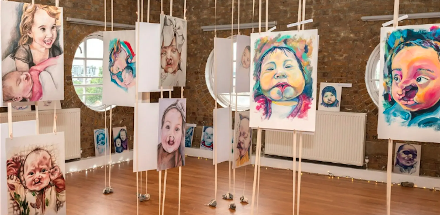 100 Cleft Portraits_4b.jpg.png